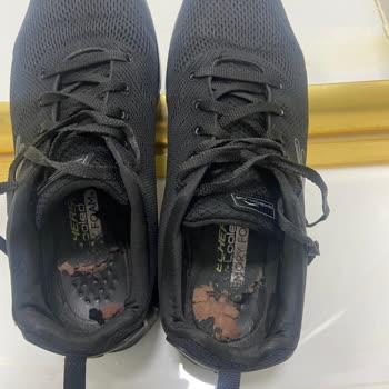 Skechers Ürün İç Tabanında Erime Ve Kopmalar Alt Tabanında Yırtılmalar
