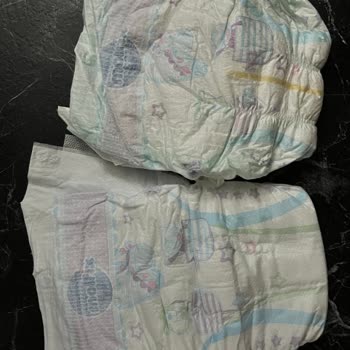 Molfix Sızdırıyor Ve Taşırıyor