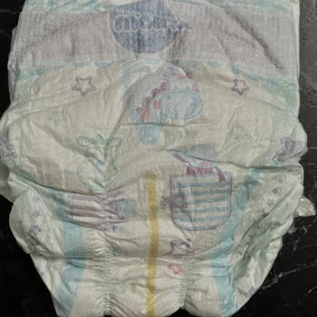 Molfix Sızdırıyor Ve Taşırıyor