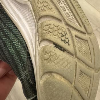 Skechers Çocuk Ayakkabısı Mağduriyet