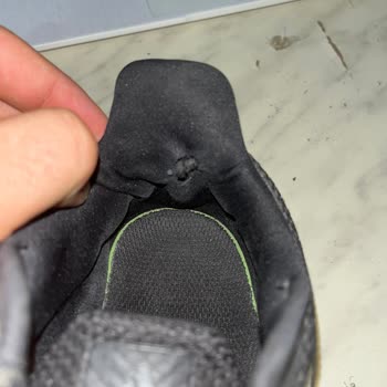 Adidas Markasının İlgisizliği Ve Mağduriyetim