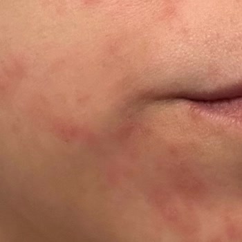 Zendora Deluxe Güzellik Salonunda Cilt Bakımı