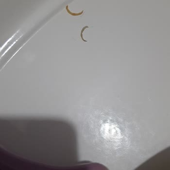 Şampiyon Kokoreç Kokoreç İçinden Çıkan İnsan Tırnağı