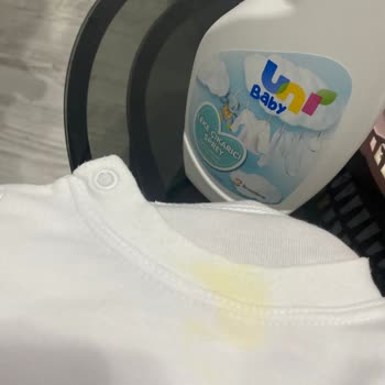 Uni Baby Leke Çıkarıcı Sprey
