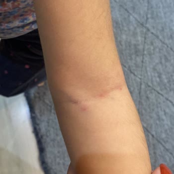 Medicana Hospitals Yetersiz Hizmet Veren Hemşire