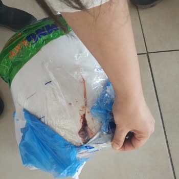 MNG Kargo Atalar Şubesi Kargomu Kırık Getirdi