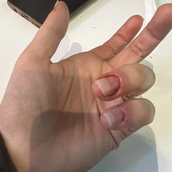 Eyüp Protez Tırnak Manikür Faciası, Tırnağım Dipten Kırıldı