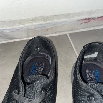 Skechers Satış Sonrası Hizmetin Olmaması