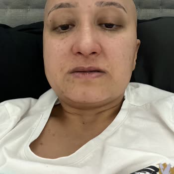 Acıbadem Hastanesi Beyin Kanseri Hasta Şikayeti