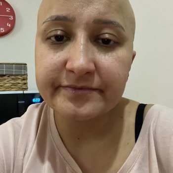 Acıbadem Hastanesi Beyin Kanseri Hasta Şikayeti