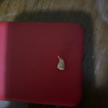 BİM Üründen Diş Kırılması