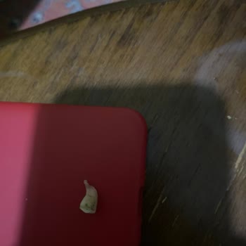 BİM Üründen Diş Kırılması