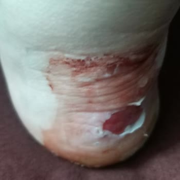 Calvin Klein Yeni Botlar Ayaklarımı Yaraladı