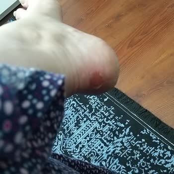 Calvin Klein Yeni Botlar Ayaklarımı Yaraladı