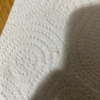 Arı Mama Açtığım Paketin İçinden Kurumuş Kurt Çıktı