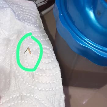 High Nutrition Ürün İçerisinden Solucana Benzer Bir Şey Çıktı