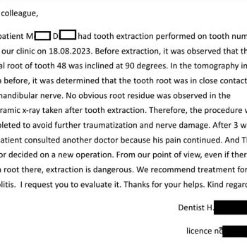 A Plus Dental (Kahramanmaraş) 20lik Diş Çekimi Komplikasyonu