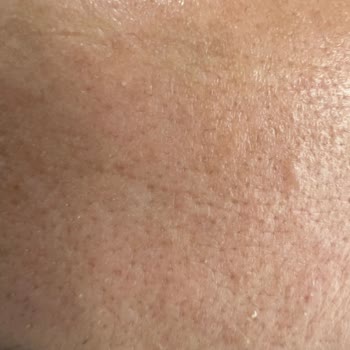 Formmed Polikliniği Cilt Bakımından Memnun Kalmadım. Söylediğimde Benimle Tartıştılar