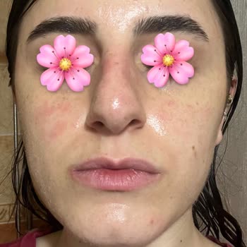 Sinem Ekici Beauty Cilt Bakımı