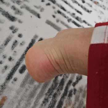 Cat-turkiye.com Cat Botu Ayağımı Mahvetti