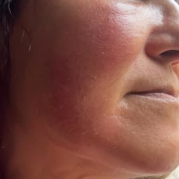 Suit Güzellik Merkezleri Suit Çayyolu Güzellik Merkezi