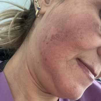 Suit Güzellik Merkezleri Suit Çayyolu Güzellik Merkezi