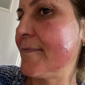 Suit Güzellik Merkezleri Suit Çayyolu Güzellik Merkezi