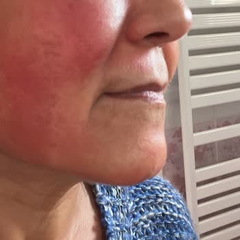 Suit Güzellik Merkezleri Suit Çayyolu Güzellik Merkezi