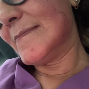 Suit Güzellik Merkezleri Suit Çayyolu Güzellik Merkezi