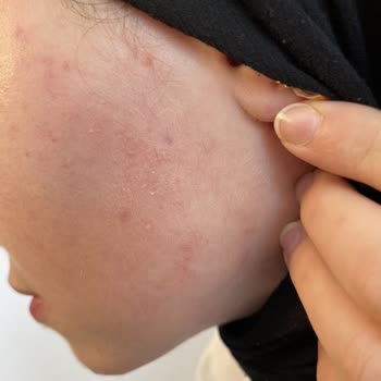 Bioliq İnsan Sağlığındaki Sorumsuzluğu