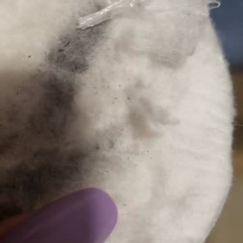 Watsons Pamuktan Çıkan Yabancı Cisim