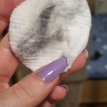 Watsons Pamuktan Çıkan Yabancı Cisim