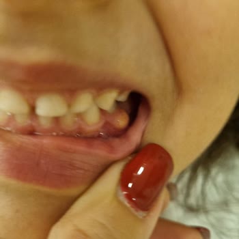 Işık Diş Ağız Ve Diş Sağlığı Polikliniği Çocuklarımın Dişlerini Mahvettiler, Bir Dolguyu Dahi Beceremediler