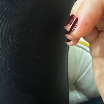 Chill Nail & Beauty Hijyen, Keserek Manikür Yapılması, Kirlilik