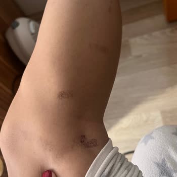 Hola Beauty (Ankara) Epilasyon Hizmeti Ve Müşteri Mağduriyeti Şikayeti