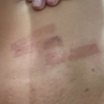 Hola Beauty (Ankara) Epilasyon Hizmeti Ve Müşteri Mağduriyeti Şikayeti