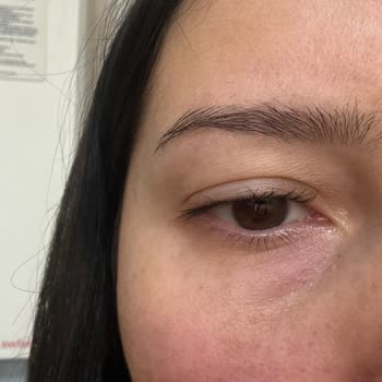 Nakkaş Med-Est Güzellik Merkezi Kirpik Lifting Yaptırmayın