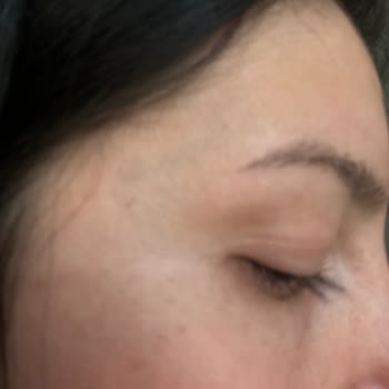 Nakkaş Med-Est Güzellik Merkezi Kirpik Lifting Yaptırmayın