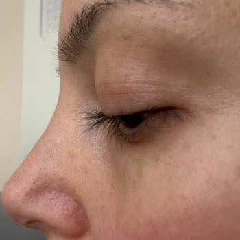 Nakkaş Med-Est Güzellik Merkezi Kirpik Lifting Yaptırmayın