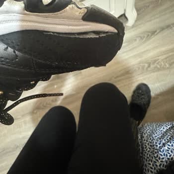 Skechers Ayakkabının Yırtılması Ve İnceleme İşlemi