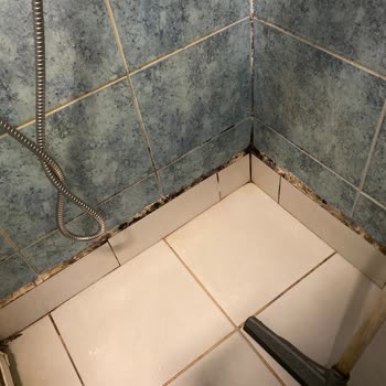 Hacettepe Üniversitesi Hastanesi Genel Cerrahi Bölümü!