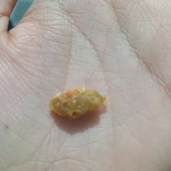 BİM Party Mısır Cipsinin İçinden Taş Çıktı