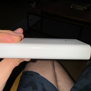 Xiaomi Powerbank Şişip Çatladı Ve Şu An Patlamak Üzere