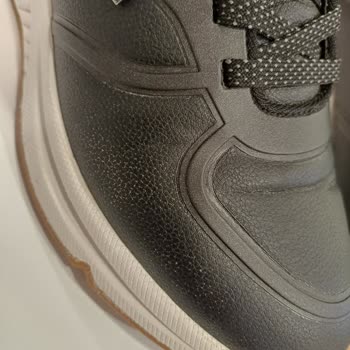 Skechers 1 Günde Derisi Dökülen Spor Ayakkabım
