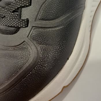 Skechers 1 Günde Derisi Dökülen Spor Ayakkabım
