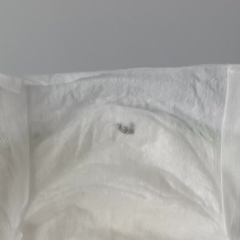 Bebem Natural Bebek Bezi İçinde Yabancı Cisim