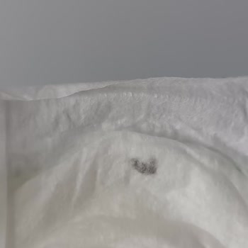 Bebem Natural Bebek Bezi İçinde Yabancı Cisim