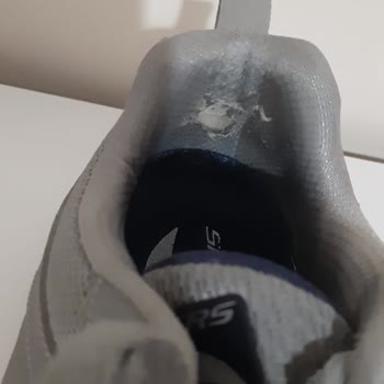 Skechers 1 Ay İçinde Oluşan Ayakkabı Yırtığı
