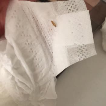 Pure Baby Bebek Bezi İçinde Kurt