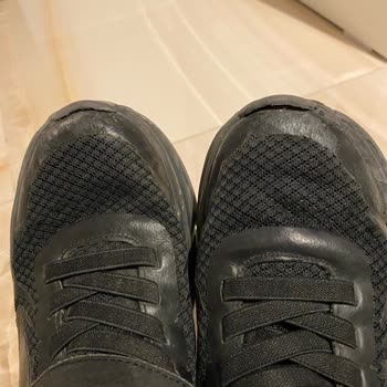 Skechers Ayakkabı 3 Ayda Yanlardan Ve Önden Açıldı.